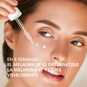 Aplicación del suero para melasma Abera en el rostro para reducir manchas oscuras y melasma
