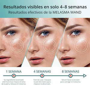Resultados visibles del tratamiento para melasma con suero facial Abera en 4 a 8 semanas