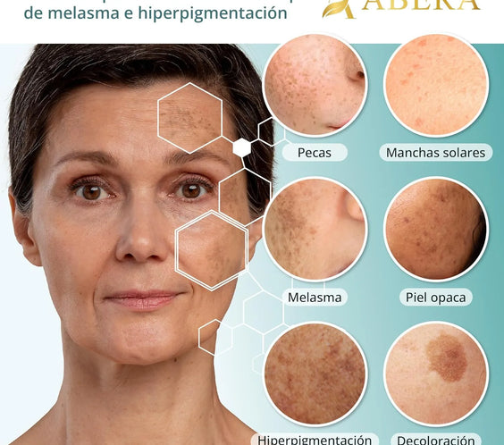 Abera Melasma Serum 30 ml