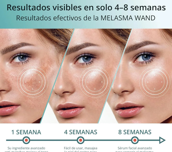Abera Melasma Serum 30 ml