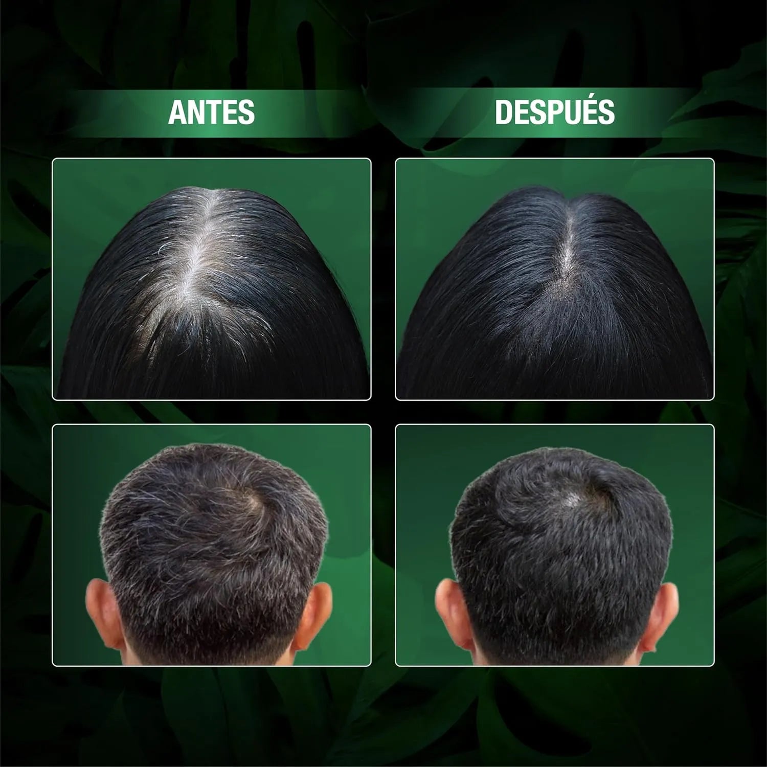 Abera Shampoo Color Negro Natural