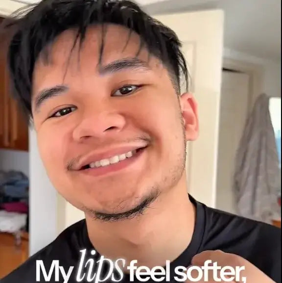 Mejora en manchas y limpieza de la piel con Abera Fordyce Cream