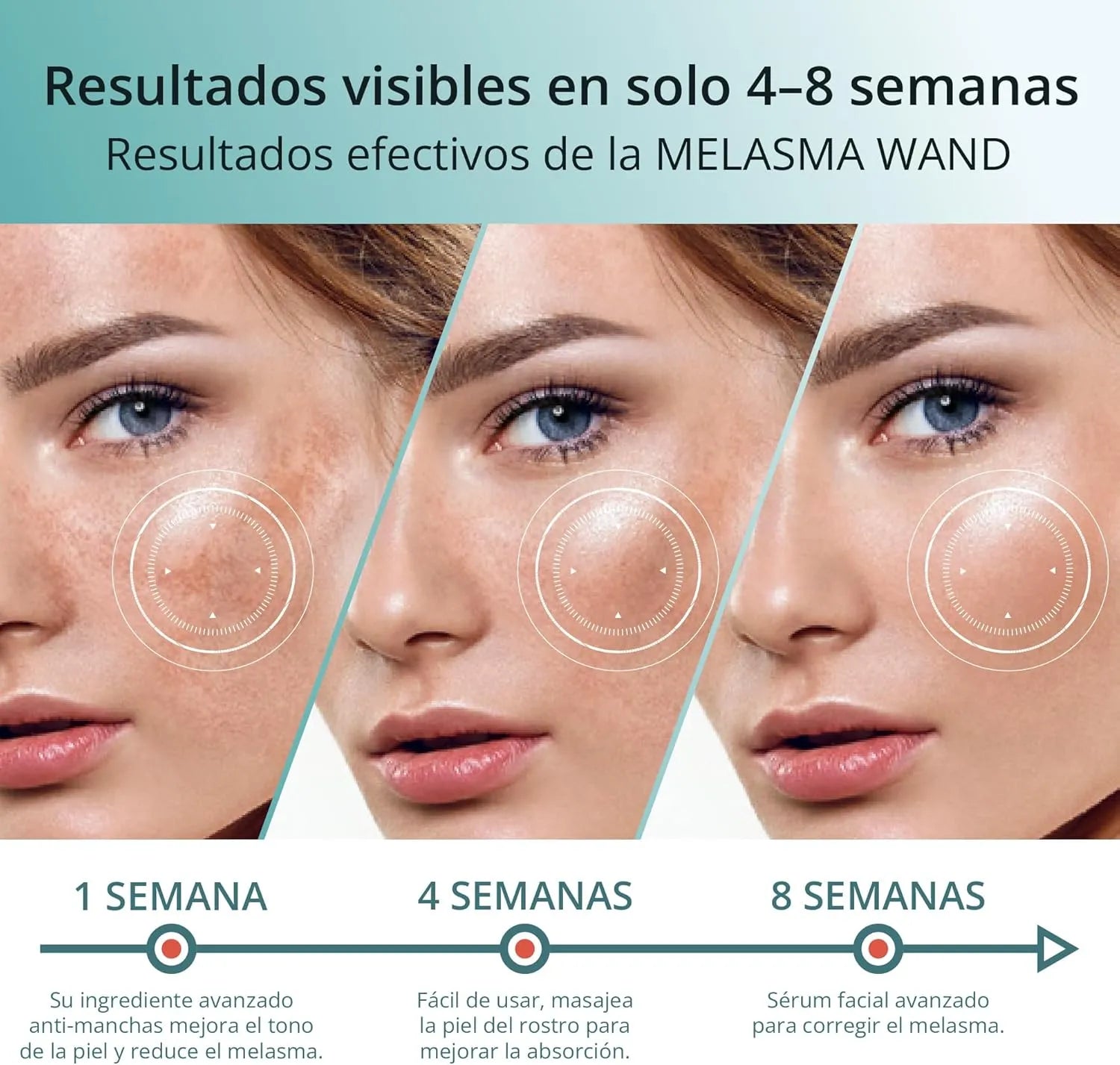 Resultados visibles del tratamiento para melasma con suero facial Abera en 4 a 8 semanas